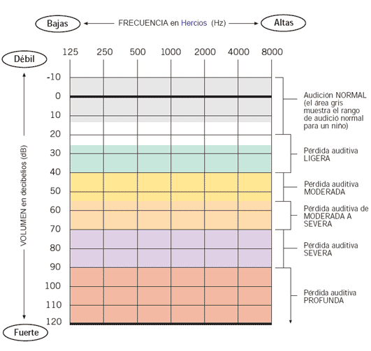 Audiograma, niveles de pérdida y audífonos