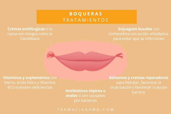 tratamientos boqueras farmacia