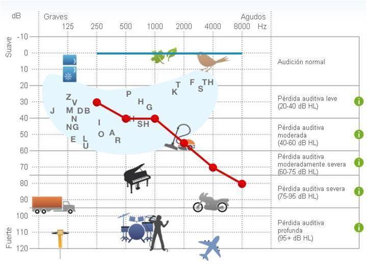 ¿Que es un audiograma?